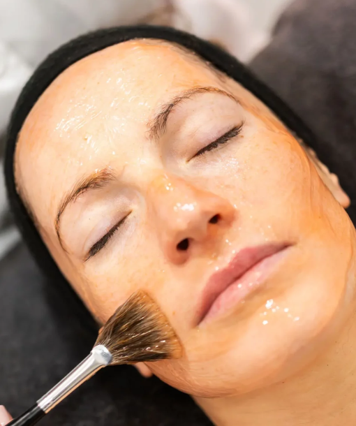 Mesoestetic Melanostop Tranex pigmentfolt-halványító hámlasztó kezelés a Sztella Estheticában, Budapesten. Luxus kozmetika, professzionális kezelések, prémium géppark. Budapest, 13,. kerület, Jászai Mari tér